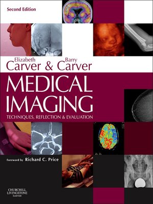 cover image of Medical Imaging--E-Book